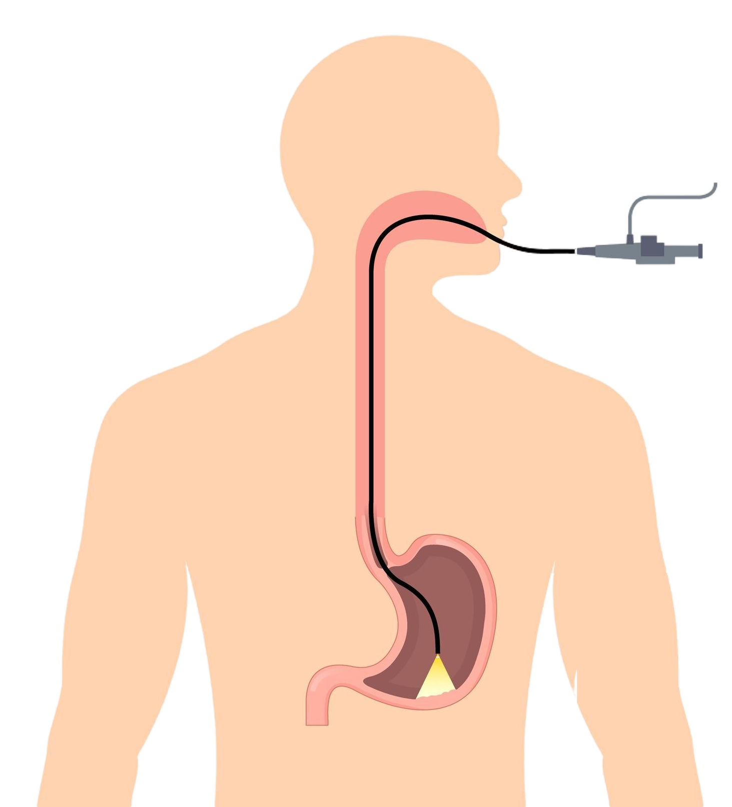 endoscopy-stomach-anatomy-equipment-vector-illustration-esophagus-endoscope-body-exam-gastroscopy-human-instrument